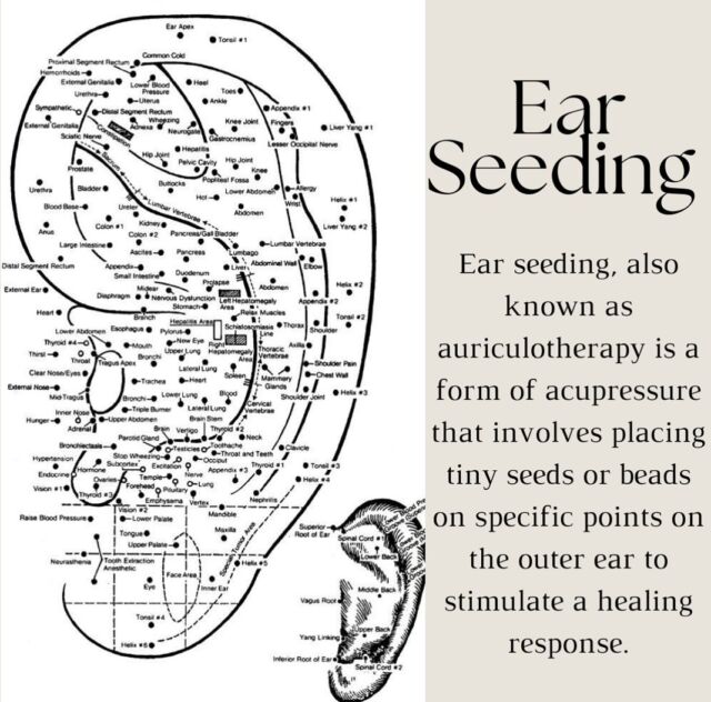 Ear seeding is Acupressure for the Ears!🕊️👂🏽✨

I invite you to the Wellness Community Market this Saturday August 10th at Compound! @compoundlbc hosted my @museapothecary 

Featuring local and regional vendors with a focus on Beauty + Wellness.✨Experience market vendors, a panel discussion, and a free community yoga class and sound bath. Discover apothecary, self-care, energy healing, yoga, meditation, breathwork, tarot and astrology readings…

* I’ll be offering free ear seeding and mini health consults. I’ll also have some yummy tea to share, so stop on by for an afternoon in Wellness + Health🤍

👂🏽Ear seeding, also known as auriculotherapy, is a form of acupressure that involves placing tiny seeds or beads on specific points of the outer ear. 

👂🏽These points correspond to various parts of the body and can be stimulated to promote a healing response and alleviate various health issues such as stress, insomnia, addiction, pain, etc.

Event Activites:

10–11 am: Free Community Lion’s Gate Kundalini Meditation + Yoga Class* led by Kelsea Mazzocco
11 am–3 pm: Community Market
2–3 pm: Speaker Panel moderated by Kristen Marie Flores featuring Bj Hickman, Janeen Aughenbaugh, and Charlotte Nguyen
3–4 pm: Free Community Sound Bath + Healing Circle* led by Temple 1209

Participating Vendors + Practitioners:
Muse Apothecary - @museapothecary
Muse Sanctuary - @the_musesanctuary
Ojos Oracle - @ojos.oracle
Tiger Blossom Studio - @tigerblossomstudio
Sinensis Company - @sinensis_co.lbc
Aether - @aetherhealing
Renaissance Woman - @renaissance.woman.co
Temple 1209 - @templetwelveohnine
David Hickman - @davidhickman.guide
Bj Hickman - @bjhickman
Kelsea Mazzocco - kundaliniwithkelsea
Janeen Aughenbaugh - @janeen.aughenbaugh
Charlotte Nguyen - @lotusinaseaoffire
Kristen Marie Flores - @ode_to_sappho

LINK IN BIO to Sign up for Free Classes / Workshops